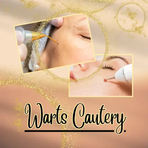 Warts Cautery